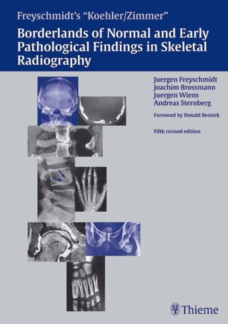 Borderlands of Normal and Early Pathologic Findings in Skeletal Radiograph main product photo