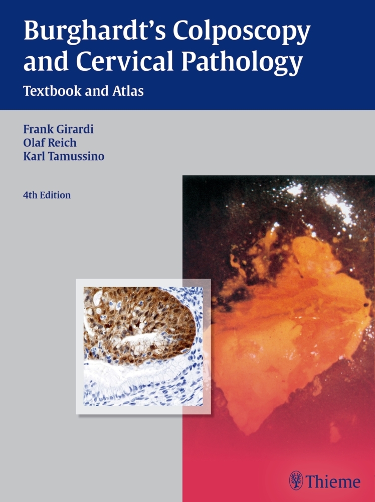 Burghardt's Colposcopy and Cervical Pathology main product photo