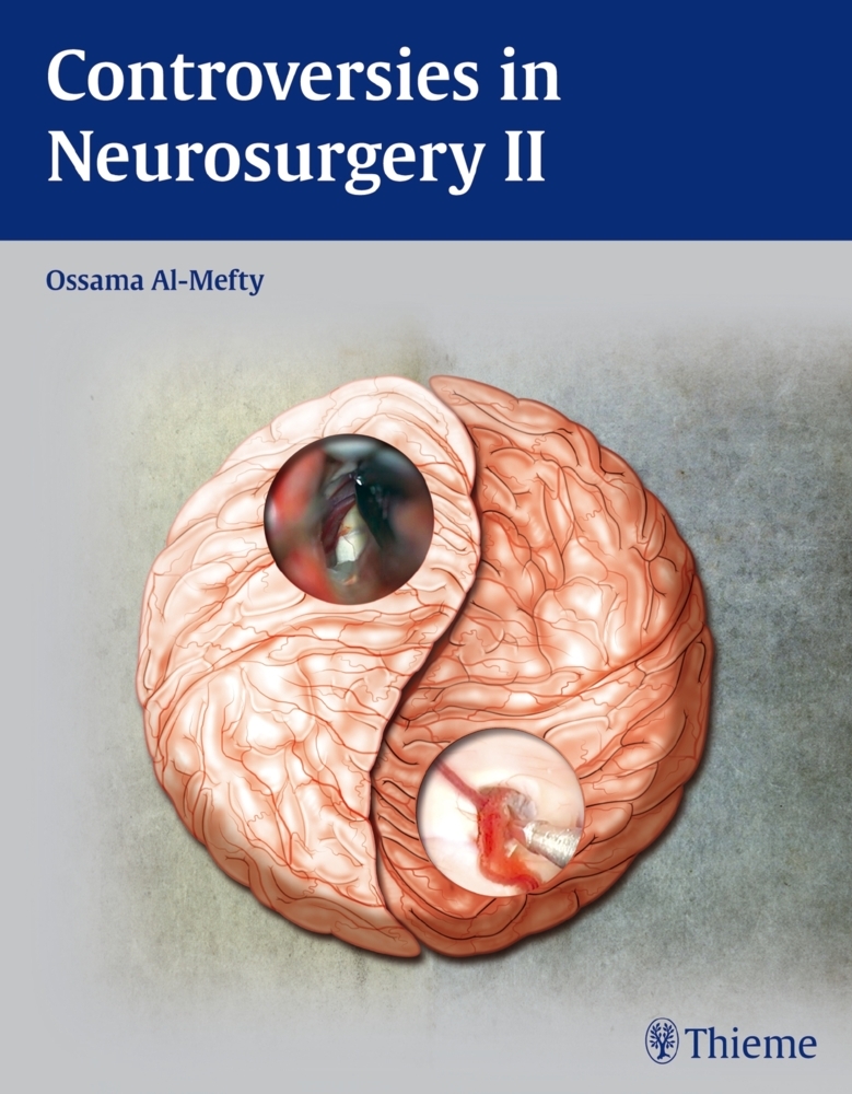 Controversies in Neurosurgery II.. Vol.2 main product photo