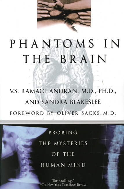 Phantoms in the Brain main product photo