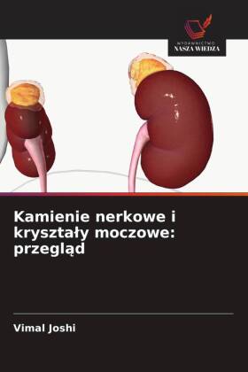 Kamienie nerkowe i krysztaly moczowe: przeglad