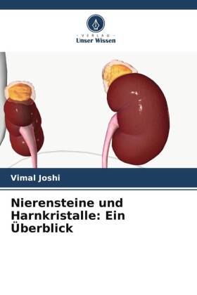 Nierensteine und Harnkristalle: Ein Überblick