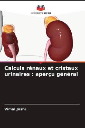 Calculs rénaux et cristaux urinaires : aperçu général