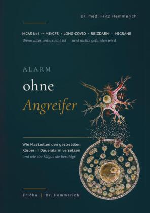 Alarm ohne Angreifer: MCAS bei ME/CFS, Long Covid, Reizdarm un...