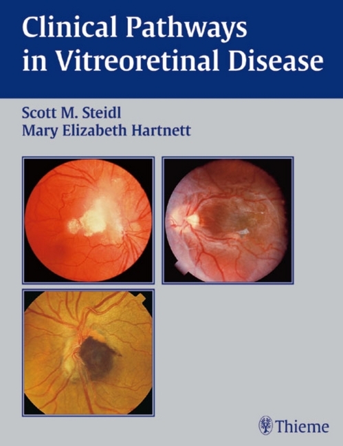 Clinical Pathways in Vitreoretinal Diseases main product photo