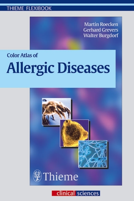 Color Atlas of Allergic Diseases main product photo