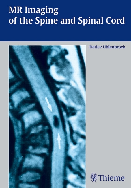 MR Imaging of the Spine and Spinal Cord main product photo