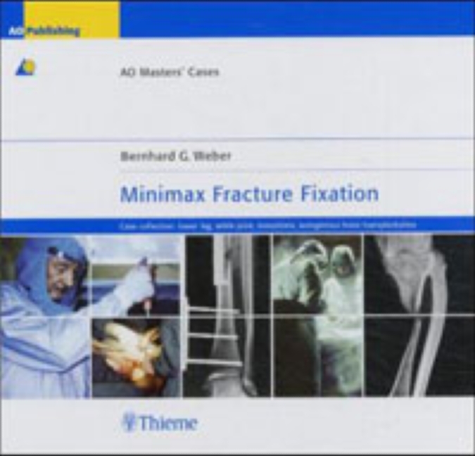 Minimax Fracture Fixation main product photo