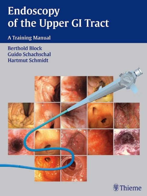 Endoscopy of the Upper GI Tract main product photo