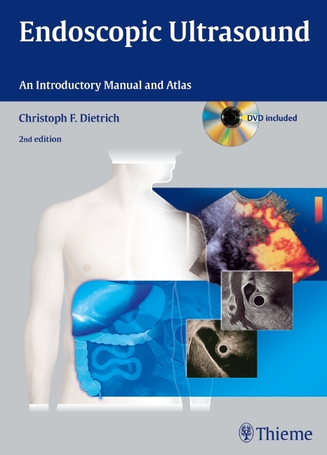 Endoscopic Ultrasound, w. DVD-ROM main product photo