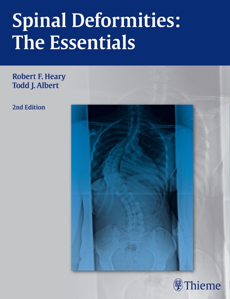 Spinal Deformities main product photo