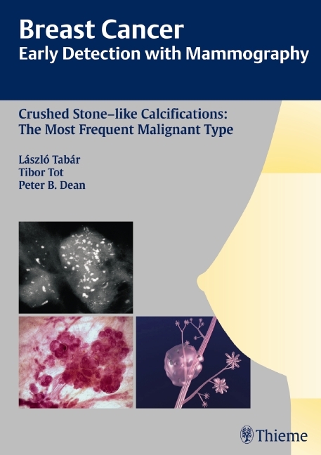 Early Detection with Mammography main product photo