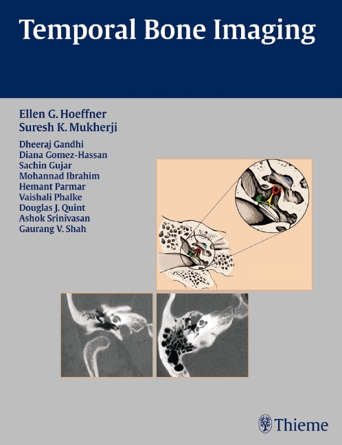 Temporal Bone Imaging main product photo