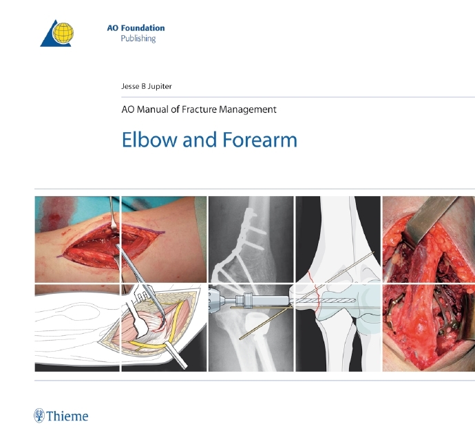 AO Manual of Fracture Management main product photo