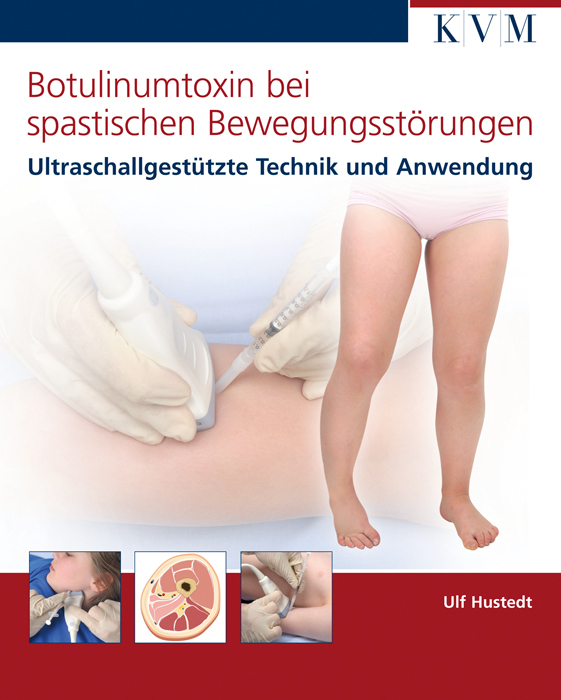 Botulinumtoxin bei spastischen Bewegungsstörungen main product photo