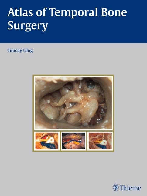Atlas of Temporal Bone Surgery main product photo
