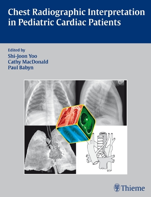 Chest Radiographic Interpretation in Pediatric Cardiac Patients main product photo