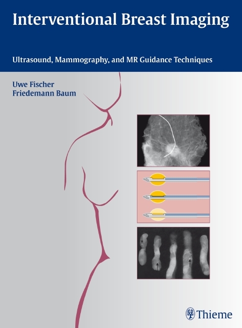 Interventional Breast Imaging main product photo