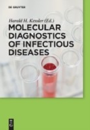 Molecular Diagnostics of Infectious Diseases main product photo