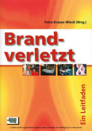 Brandverletzt