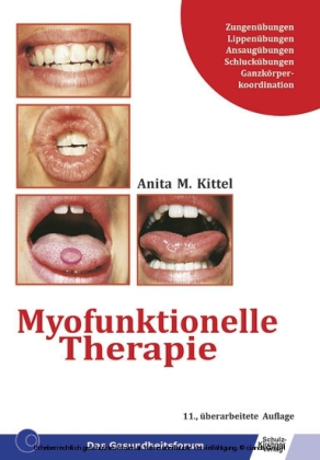 Myofunktionelle Therapie