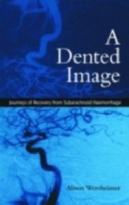 Dented Image