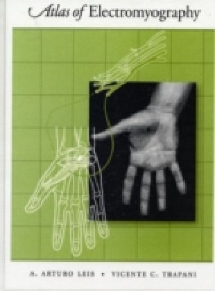 Atlas of Electromyography