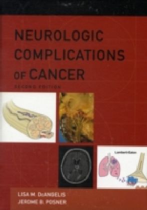 Neurologic Complications of Cancer