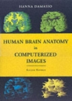 Human Brain Anatomy in Computerized Images