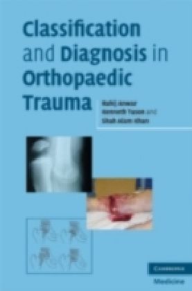 Classification and Diagnosis in Orthopaedic Trauma