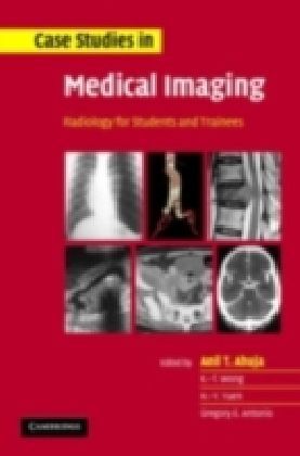 Case Studies in Medical Imaging