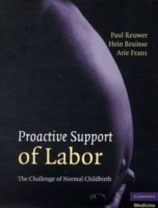 Proactive Support of Labor