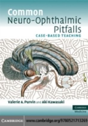 Common Neuro-Ophthalmic Pitfalls