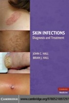 Skin Infections