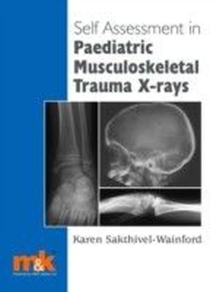 Self-assessment in Paediatric Musculoskeletal Trauma X-rays