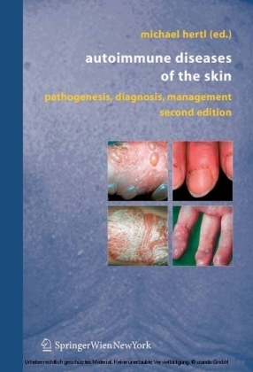 Autoimmune Diseases of the Skin