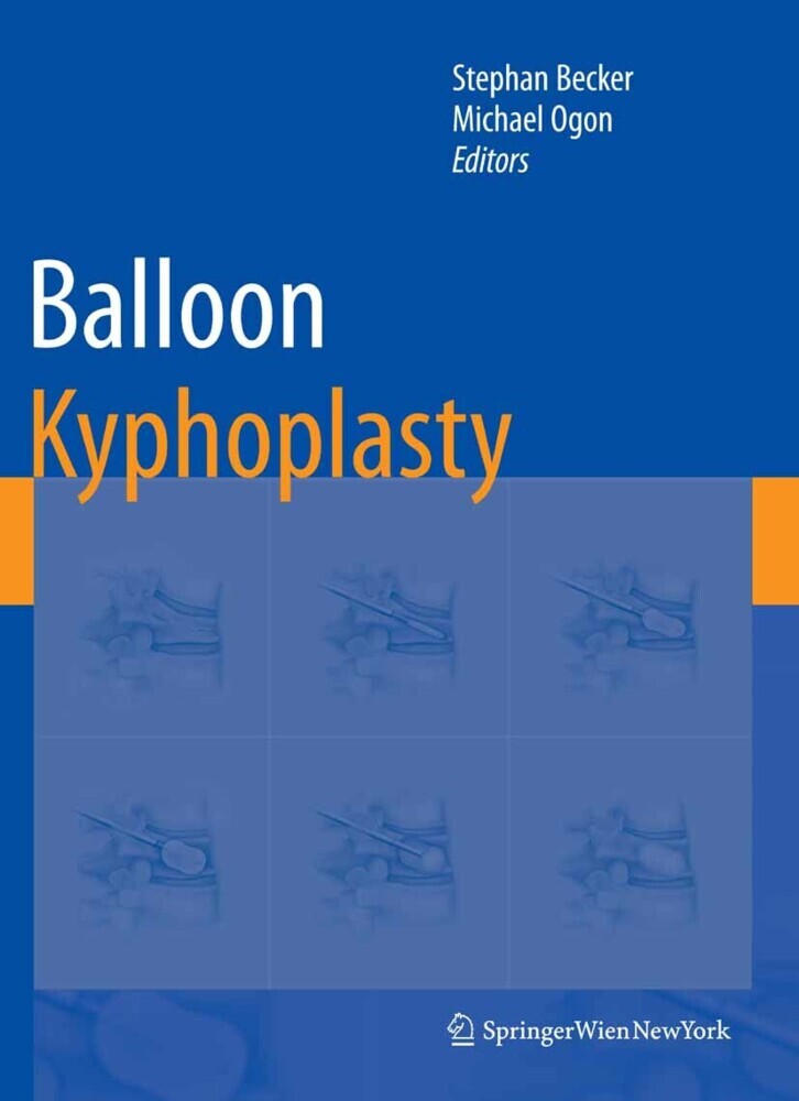 Balloon Kyphoplasty main product photo