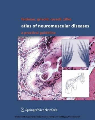 Atlas of Neuromuscular Diseases