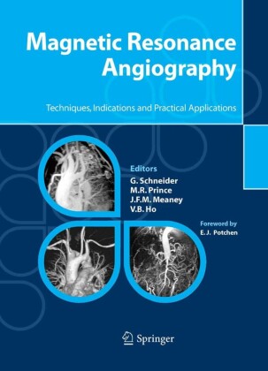 Magnetic Resonance Angiography