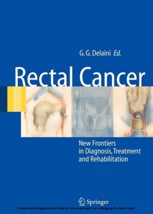 Rectal Cancer