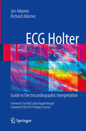 ECG Holter