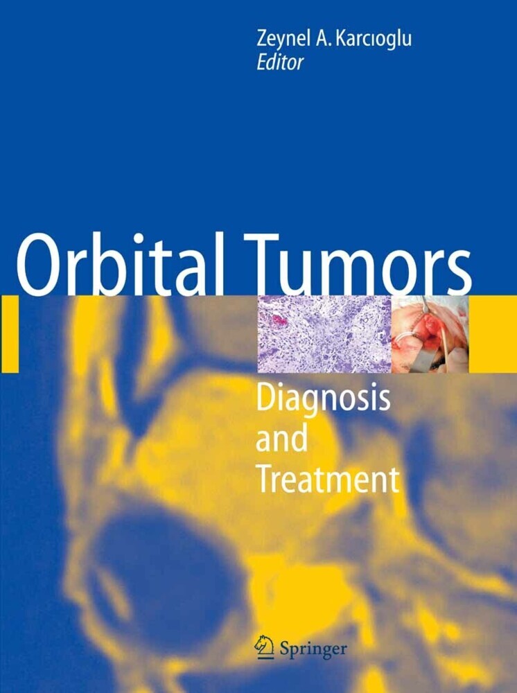 Orbital Tumors main product photo
