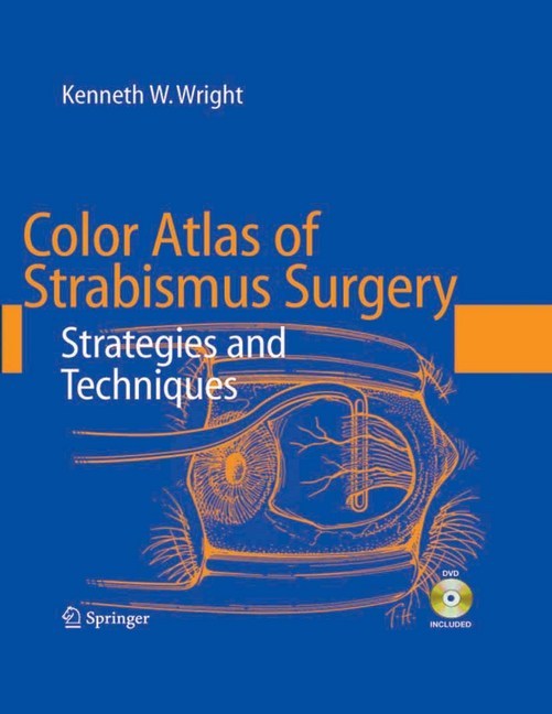 Color Atlas of Strabismus Surgery main product photo