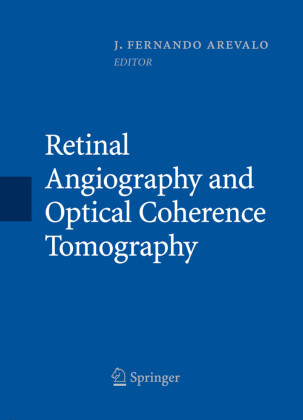 Retinal Angiography and Optical Coherence Tomography