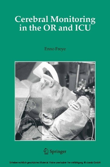 Cerebral Monitoring in the OR and ICU main product photo