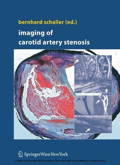 Imaging of Carotid Artery Stenosis main product photo