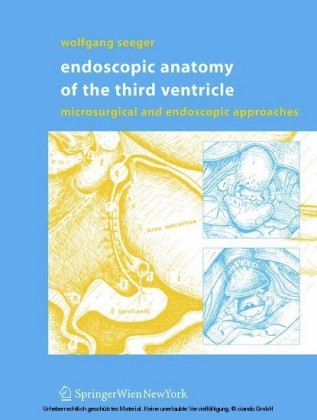 Endoscopic Anatomy of the Third Ventricle