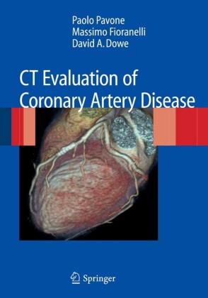 CT Evaluation of Coronary Artery Disease
