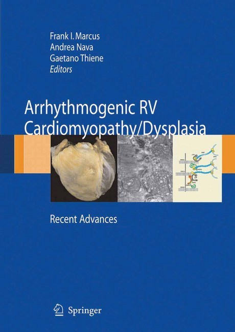 Arrhythmogenic RV Cardiomyopathy/Dysplasia main product photo