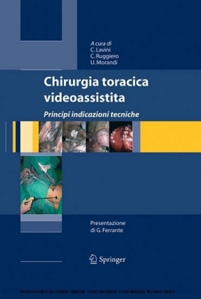 Chirurgia toracica videoassistita